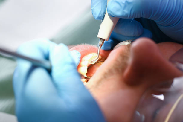 Best Emergency Treatment for Dental Infections or Abscesses in Kenova, WV