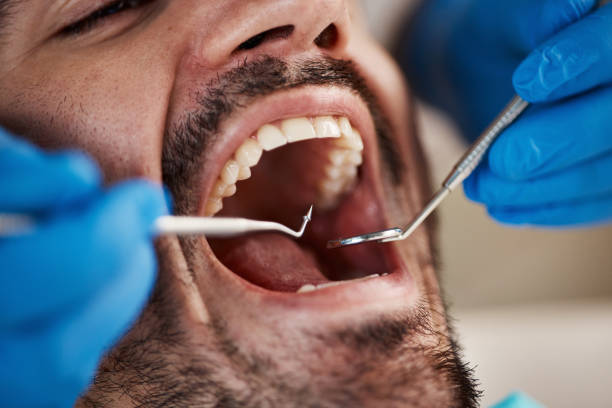 Best After-Hours Dental Trauma Care in Kenova, WV
