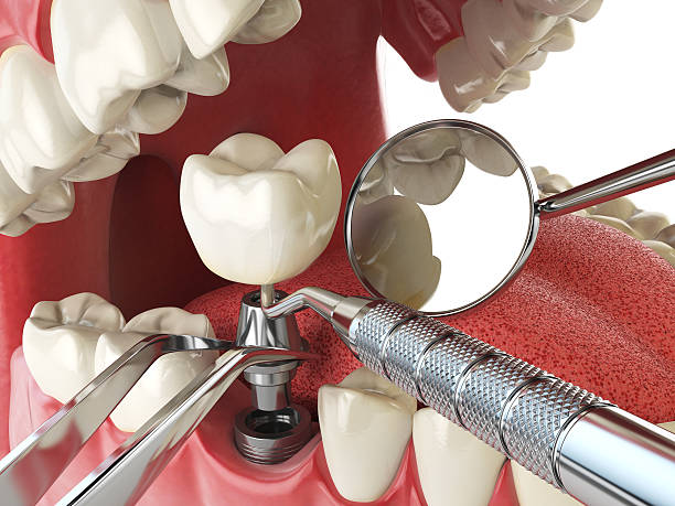 Best Urgent Care for Lost Fillings or Crowns in Kenova, WV